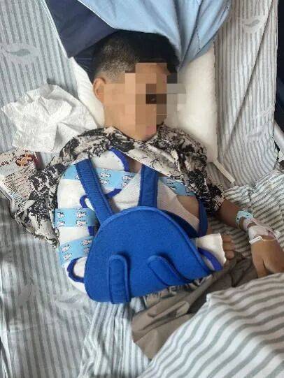 10岁男孩遭遇洗衣机“陷阱”,右臂粉碎性骨折!医生提醒
